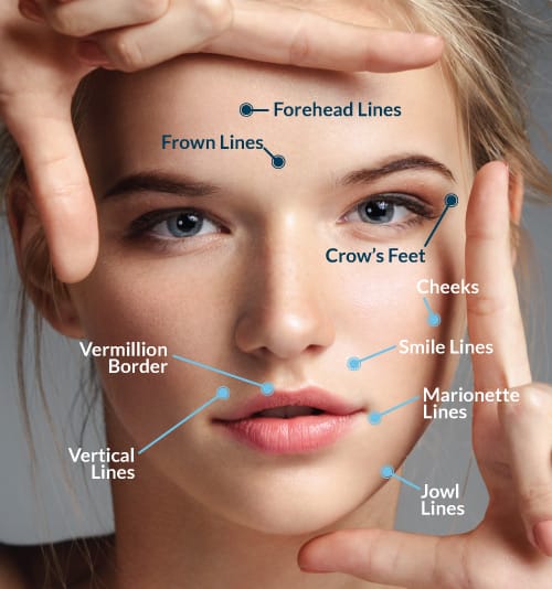 Call us today to see if you are a candidate for botulinum toxin injections near Evanston, IL. Botulinum Toxin Injections in Evanston, IL