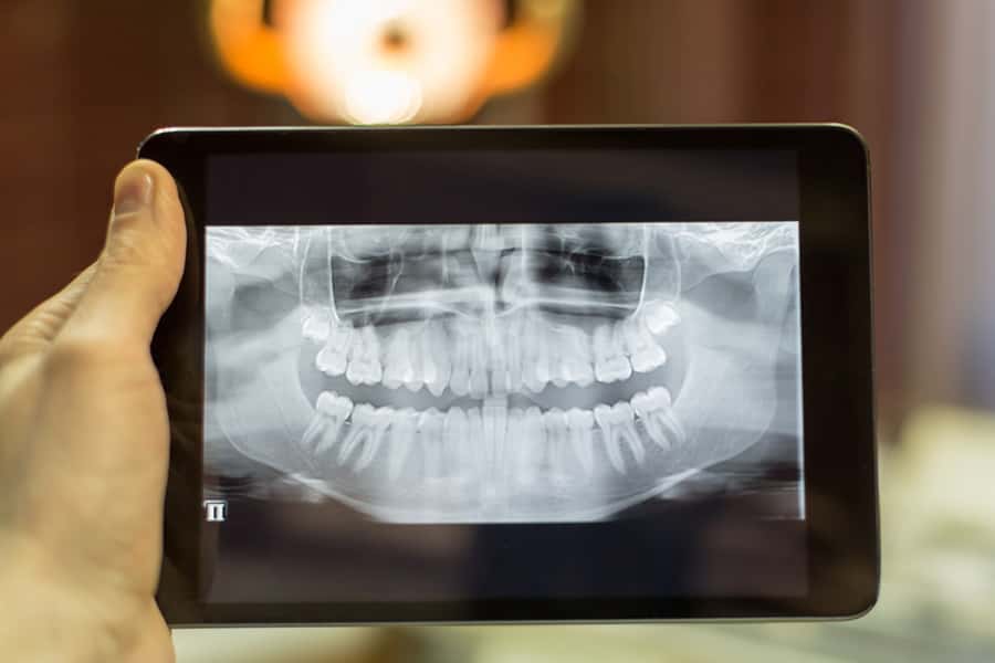 Digital Radiography in Evanston, IL