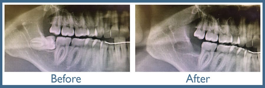 Way Dental Before and After in Evanston, IL