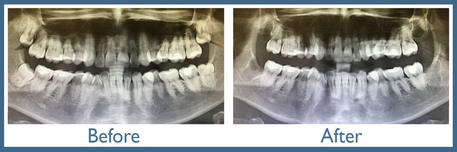 Way Dental Before and After in Evanston, IL