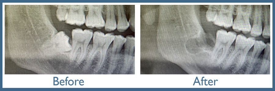 Way Dental Before and After in Evanston, IL