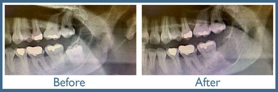 Way Dental Before and After in Evanston, IL