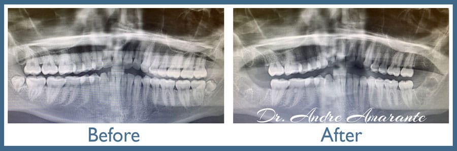 Way Dental Before and After in Evanston, IL