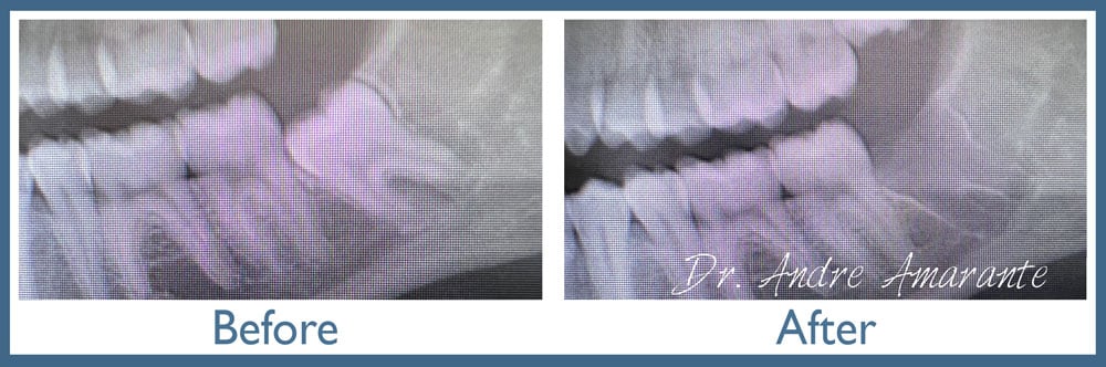 Way Dental Before and After in Evanston, IL