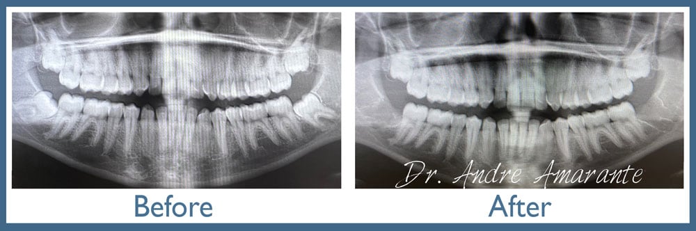 Way Dental Before and After in Evanston, IL