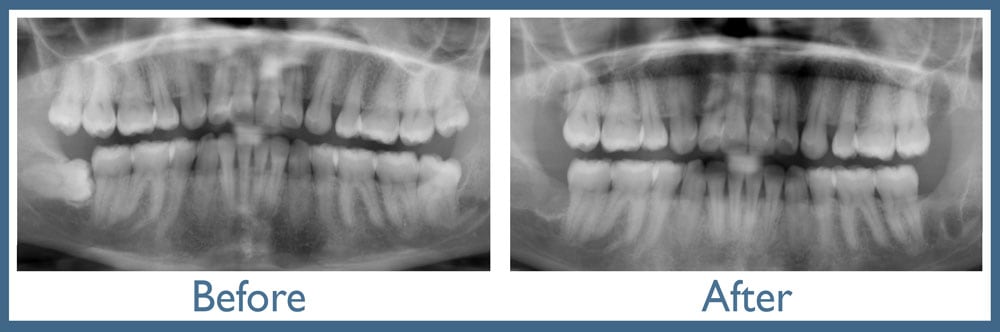 Way Dental Before and After in Evanston, IL