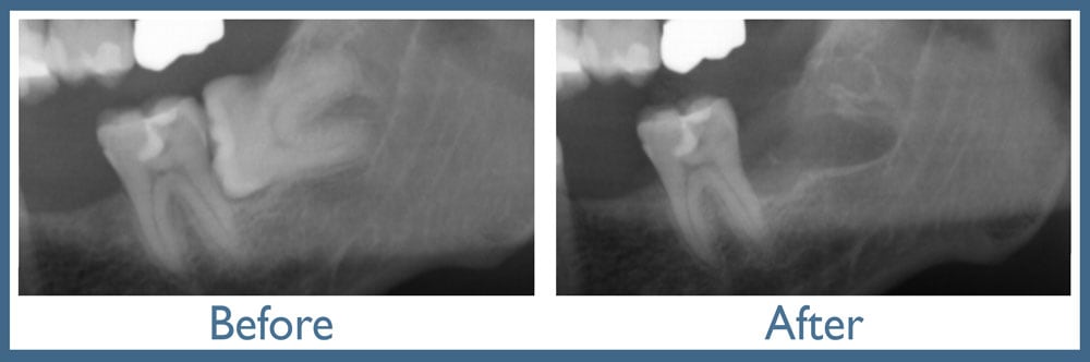 Way Dental Before and After in Evanston, IL