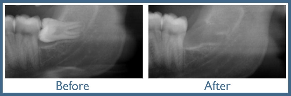 Way Dental Before and After in Evanston, IL