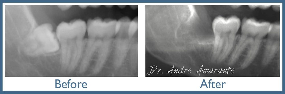 Way Dental Before and After in Evanston, IL