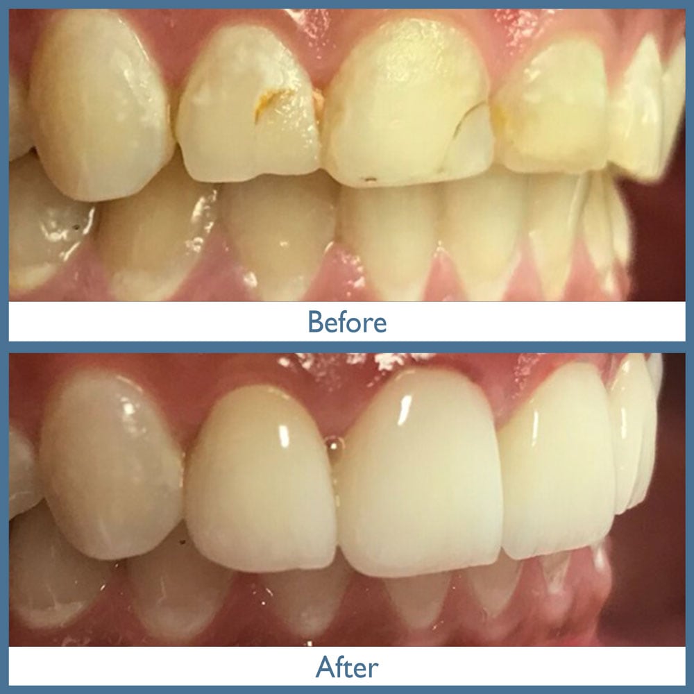 Way Dental Before and After in Evanston, IL