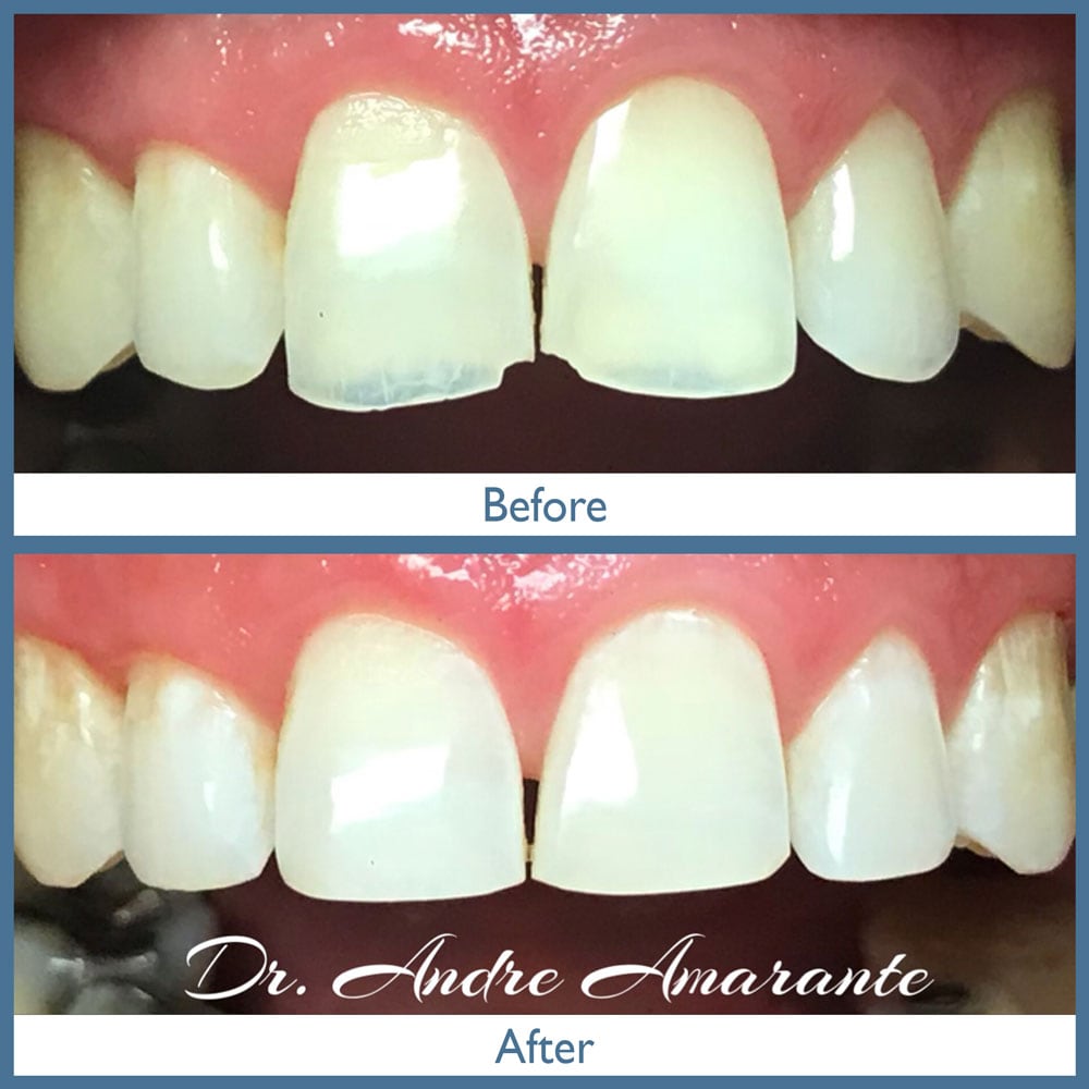 Way Dental Before and After in Evanston, IL