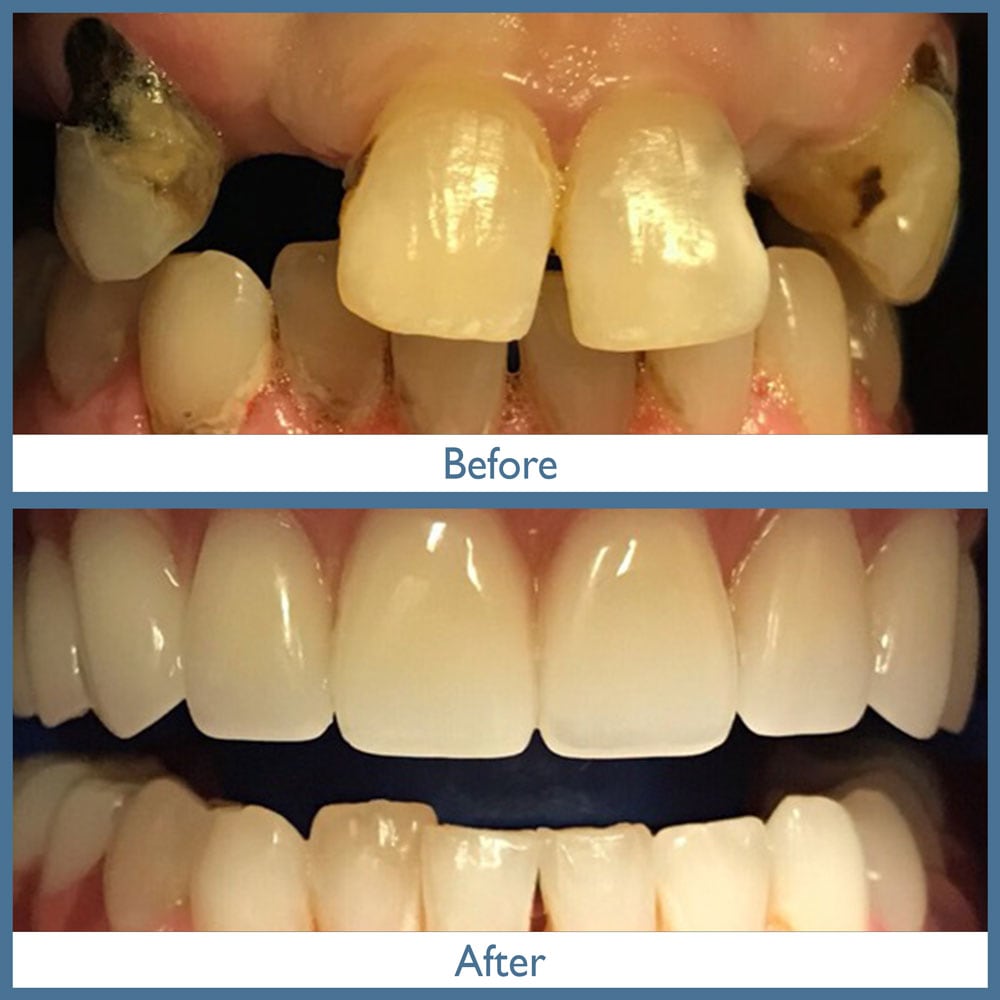 Way Dental Before and After in Evanston, IL