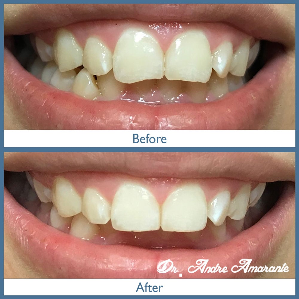 Way Dental Before and After in Evanston, IL