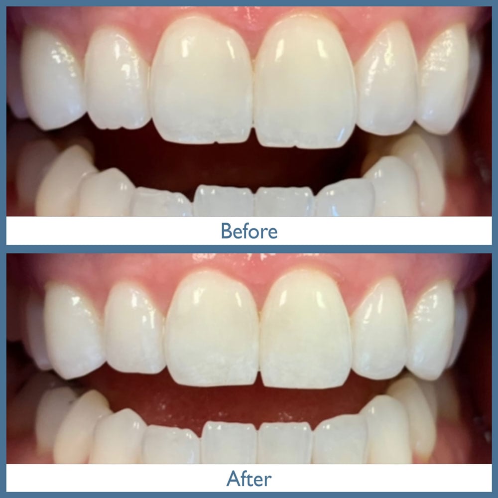 Way Dental Before and After in Evanston, IL