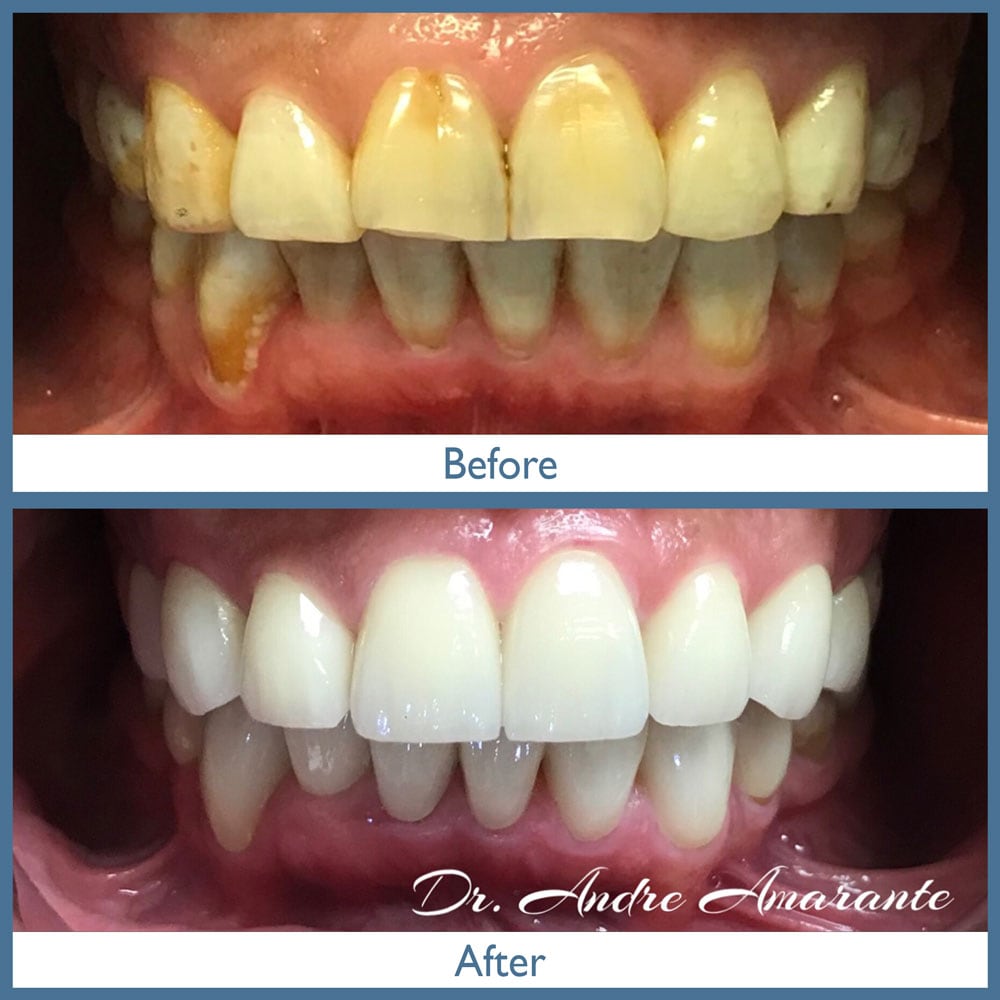 Way Dental Before and After in Evanston, IL