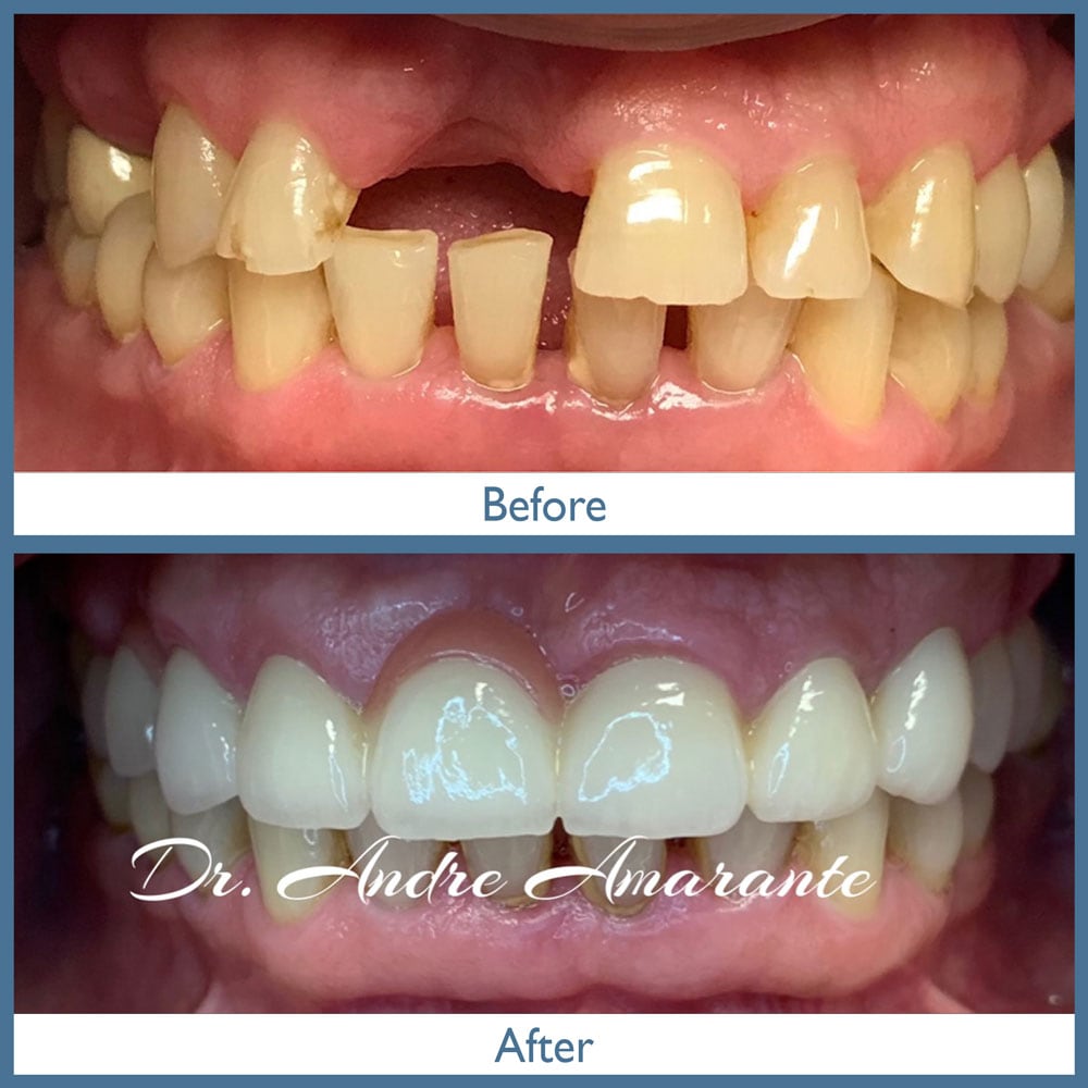 Way Dental Before and After in Evanston, IL