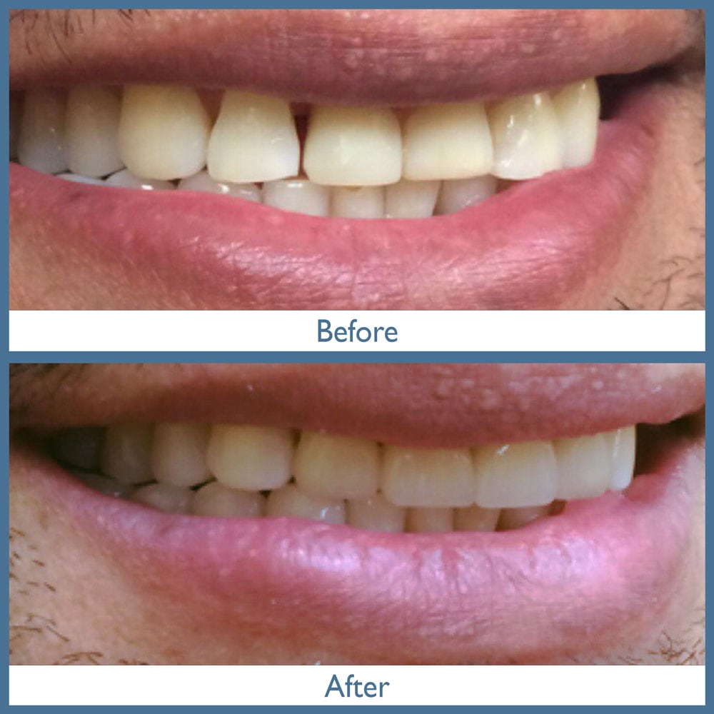 Way Dental Before and After in Evanston, IL