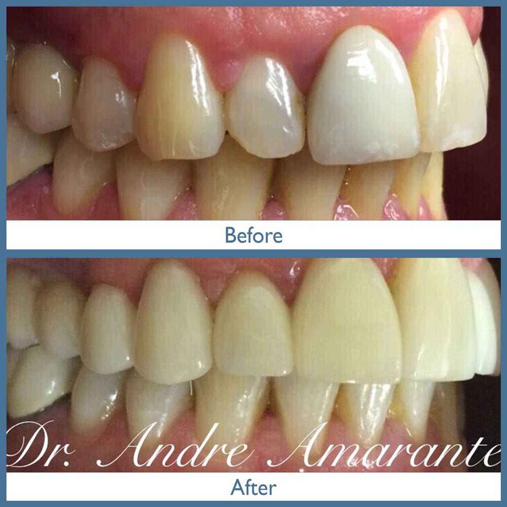 Way Dental Before and After in Evanston, IL