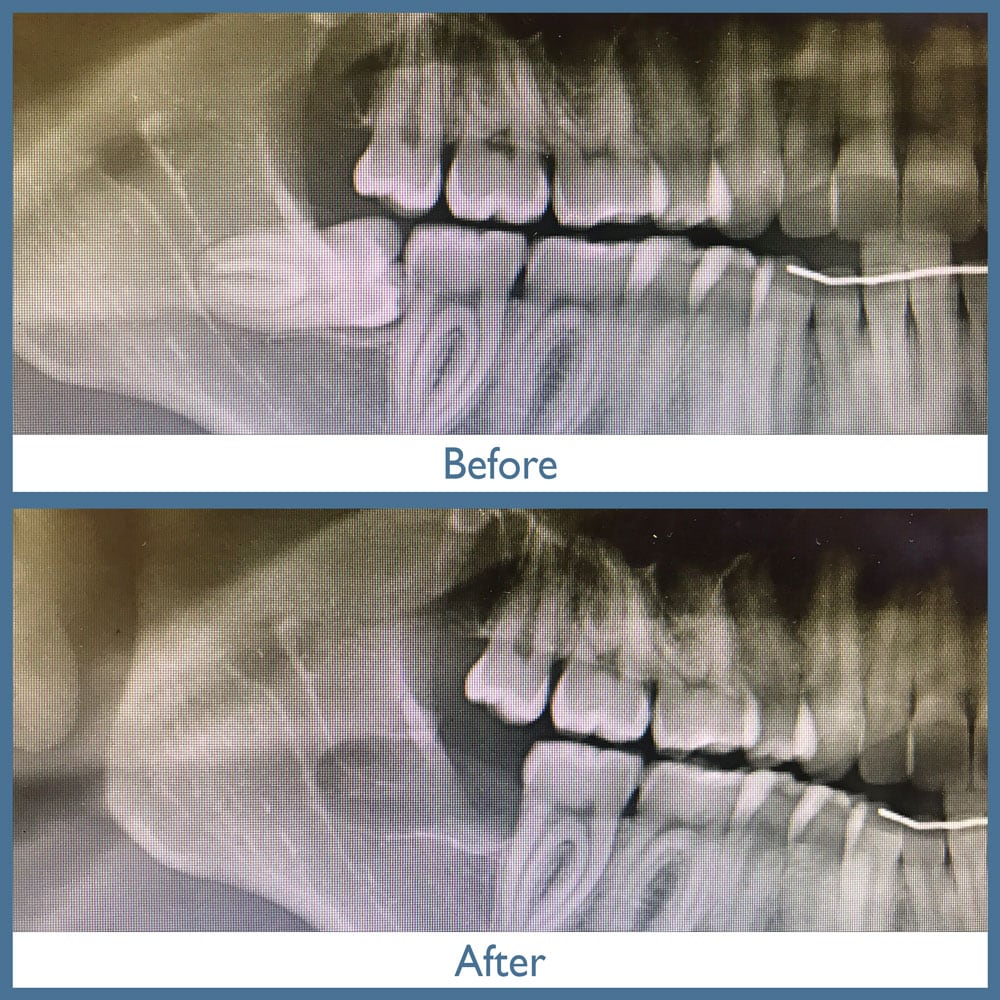 Way Dental Before and After in Evanston, IL