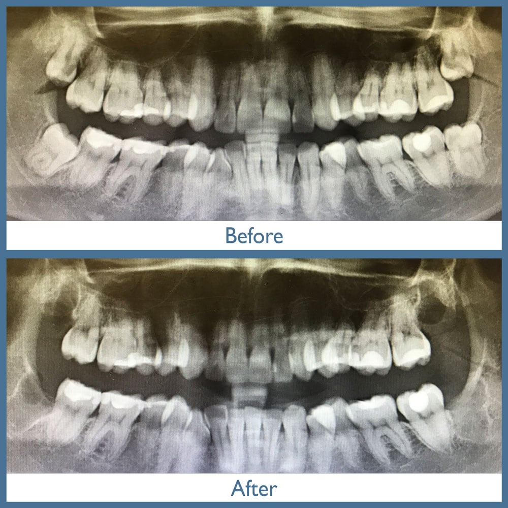 Way Dental Before and After in Evanston, IL