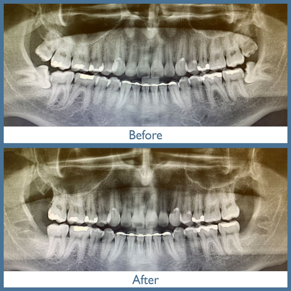 Way Dental Before and After in Evanston, IL