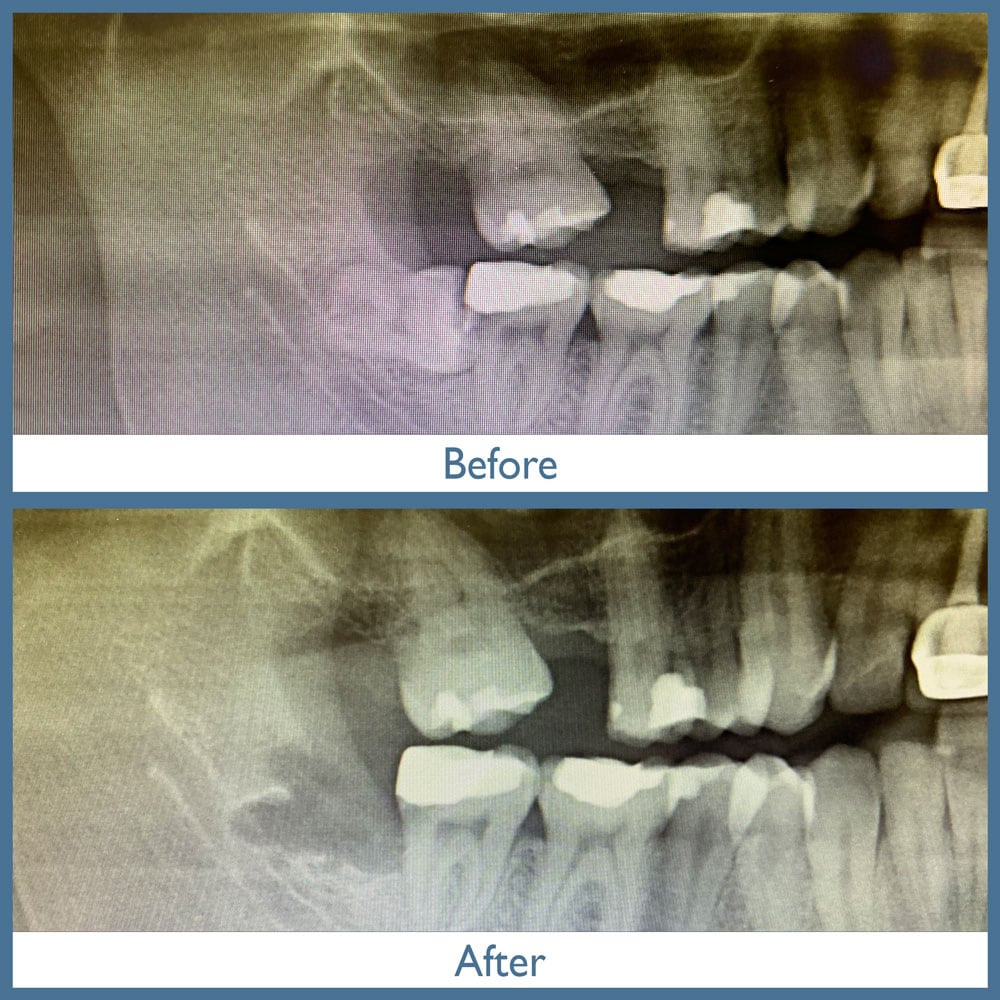 Way Dental Before and After in Evanston, IL