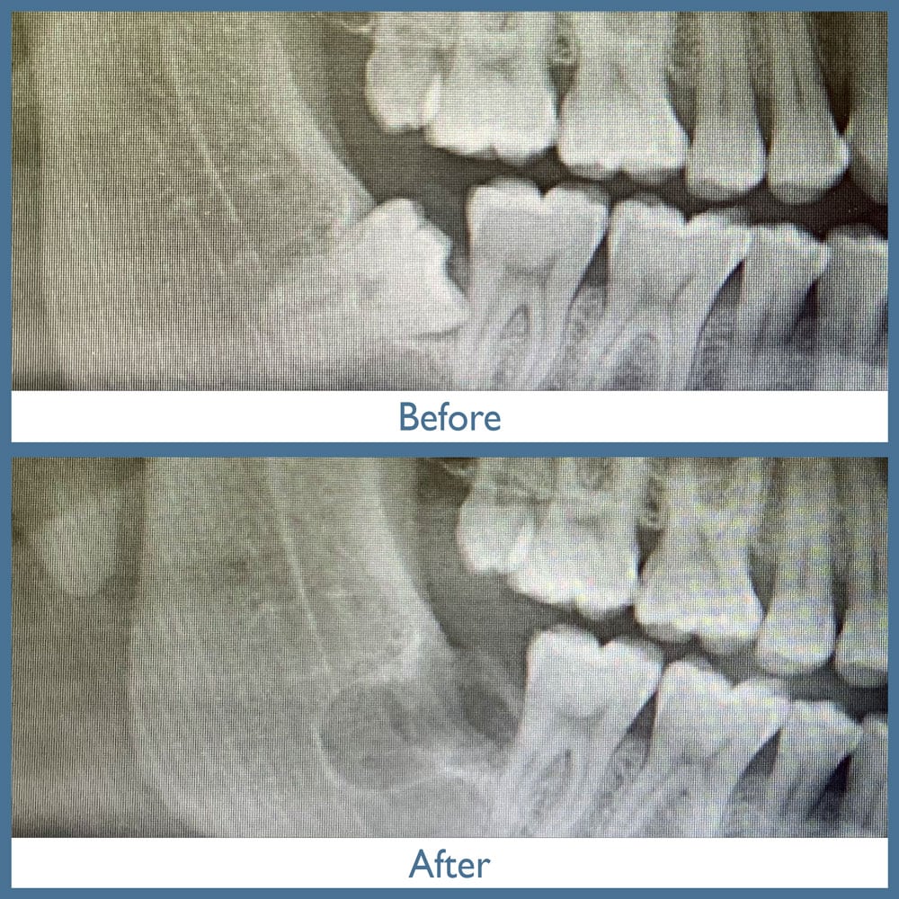 Way Dental Before and After in Evanston, IL