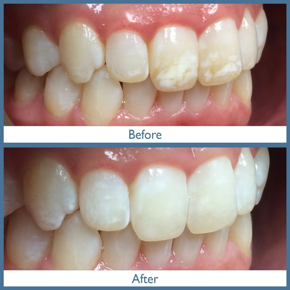 Way Dental Before and After in Evanston, IL