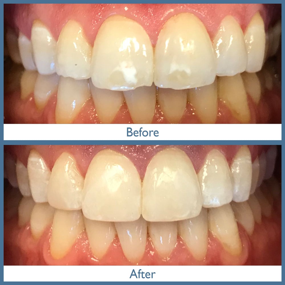 Way Dental Before and After in Evanston, IL