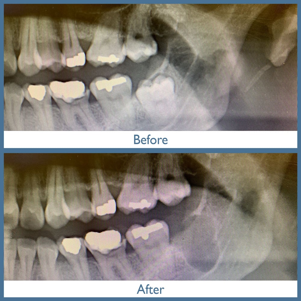 Way Dental Before and After in Evanston, IL