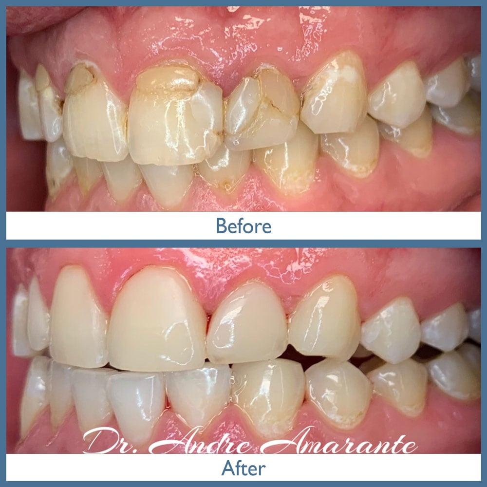 Way Dental Before and After in Evanston, IL