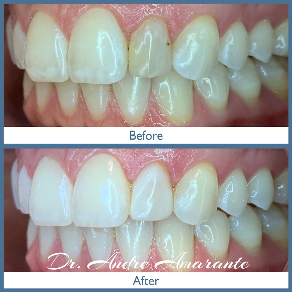 Way Dental Before and After in Evanston, IL