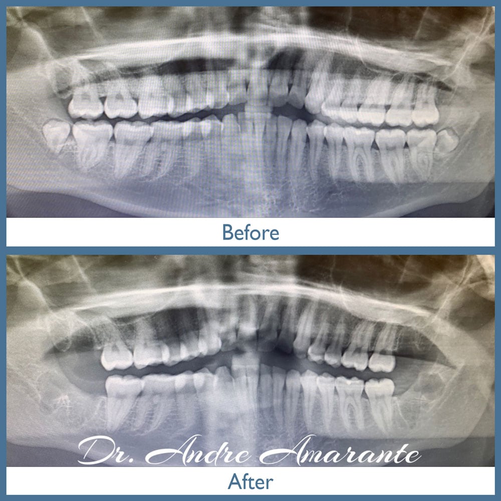 Way Dental Before and After in Evanston, IL