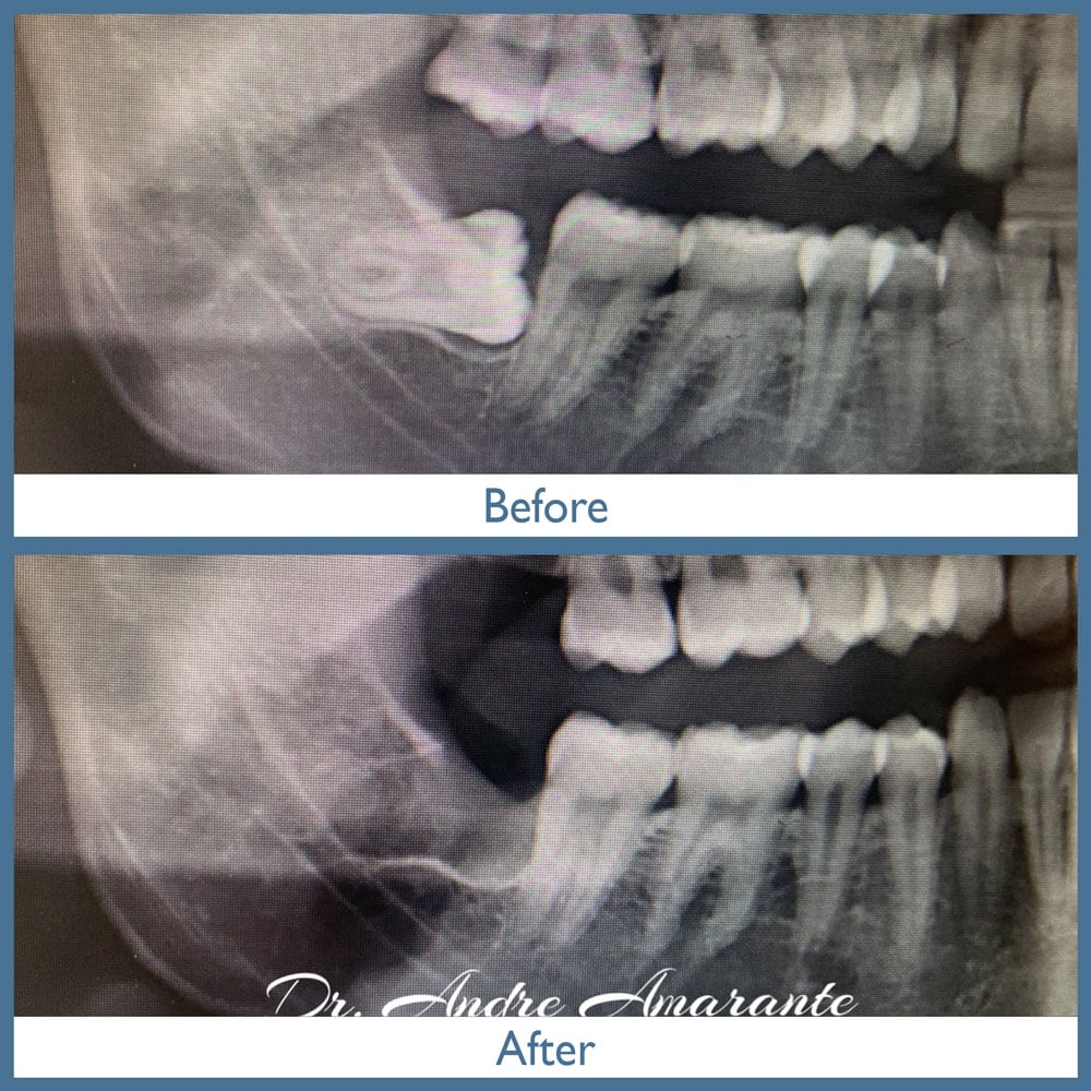 Way Dental Before and After in Evanston, IL