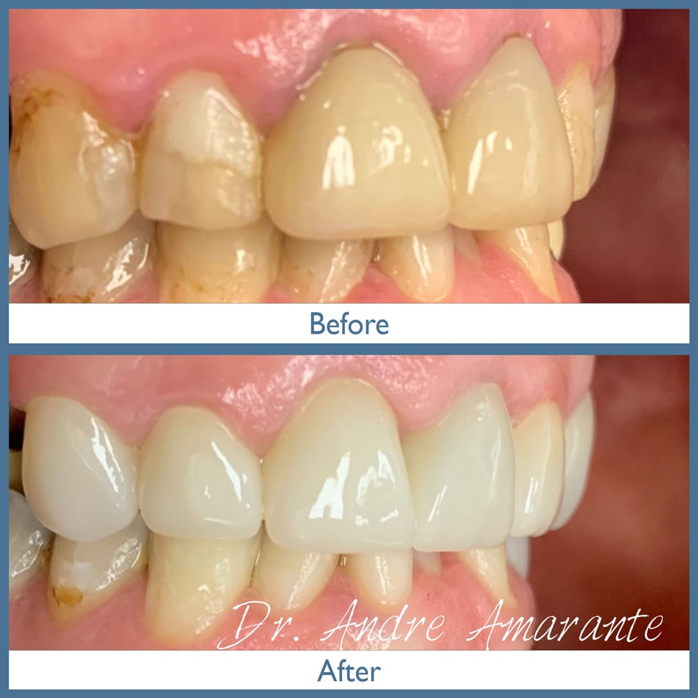 Way Dental Before and After in Evanston, IL