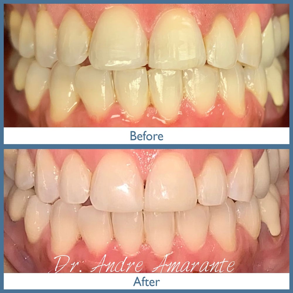 Way Dental Before and After in Evanston, IL