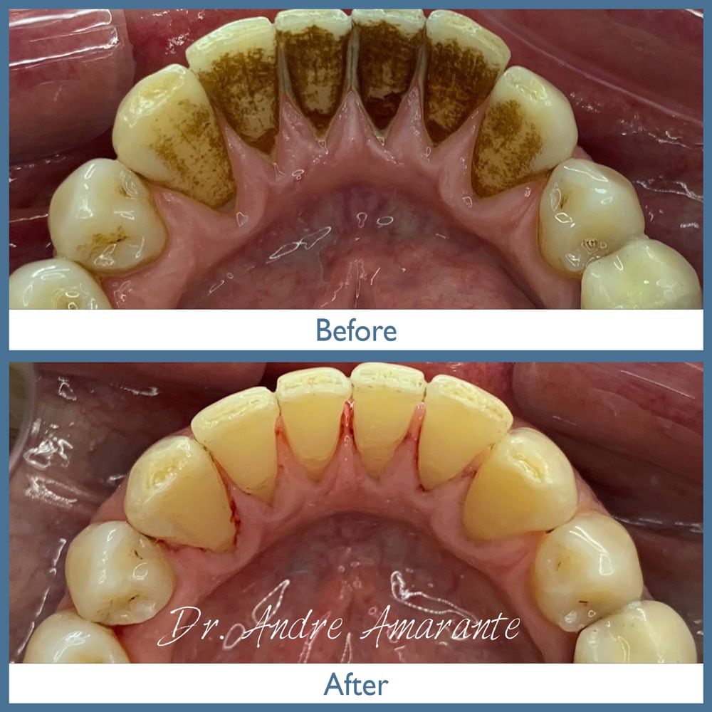 Way Dental Before and After in Evanston, IL