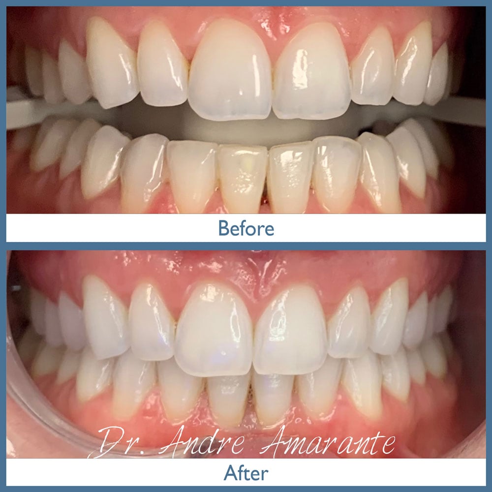 Way Dental Before and After in Evanston, IL