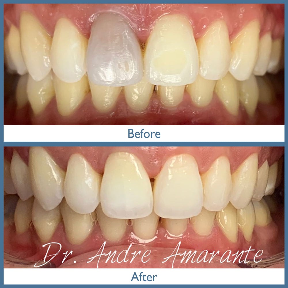 Way Dental Before and After in Evanston, IL