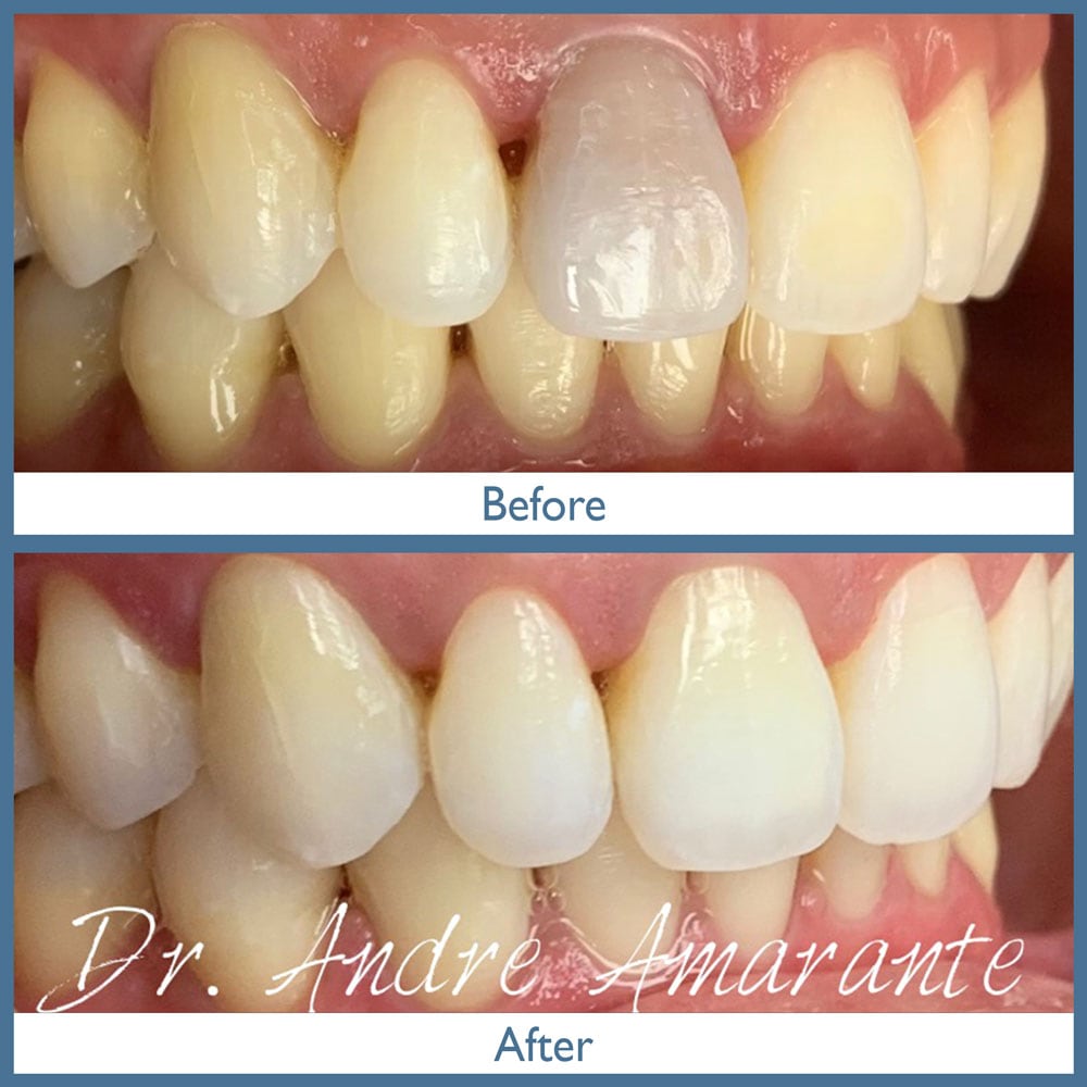 Way Dental Before and After in Evanston, IL