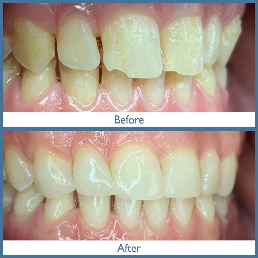 Way Dental Before and After in Evanston, IL