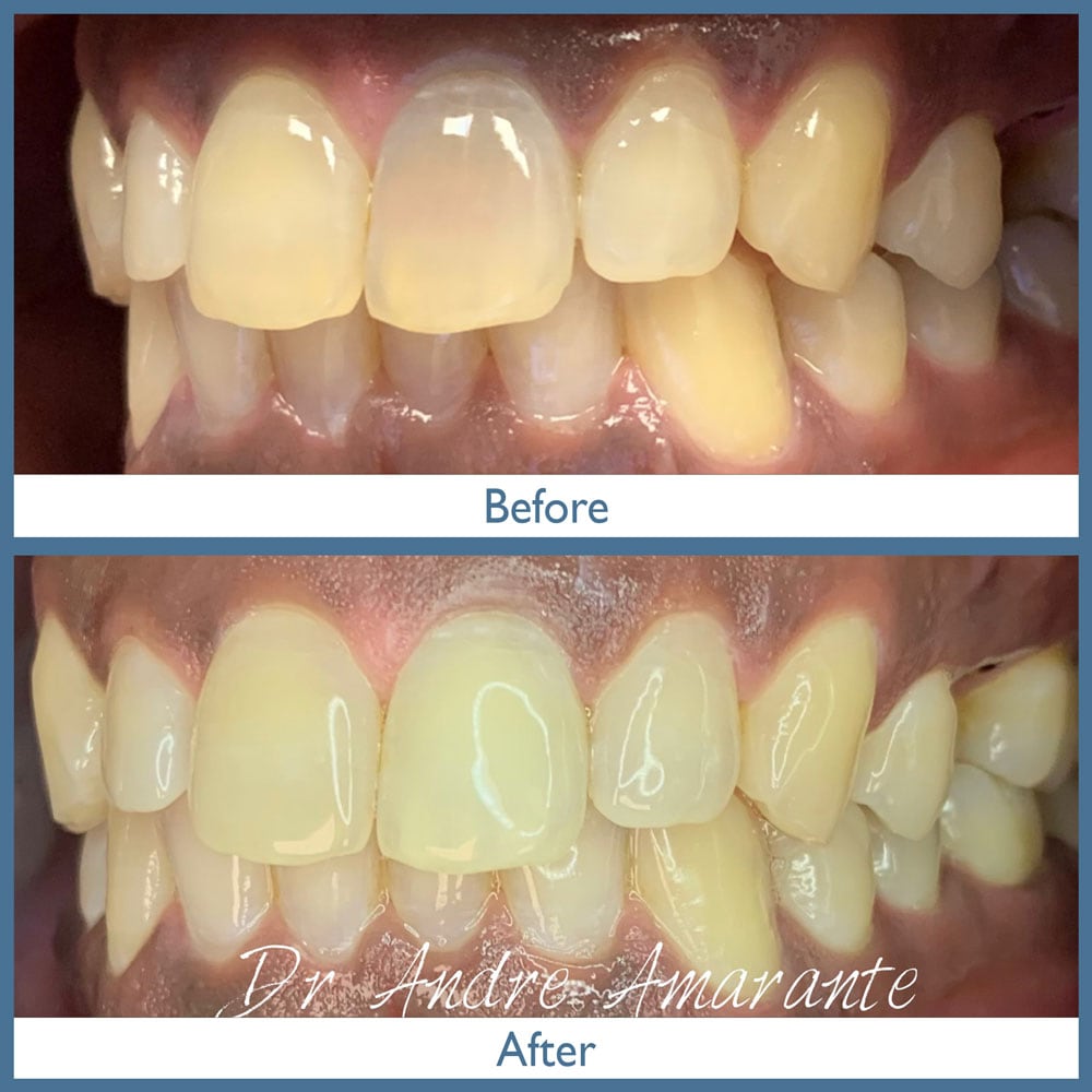 Way Dental Before and After in Evanston, IL