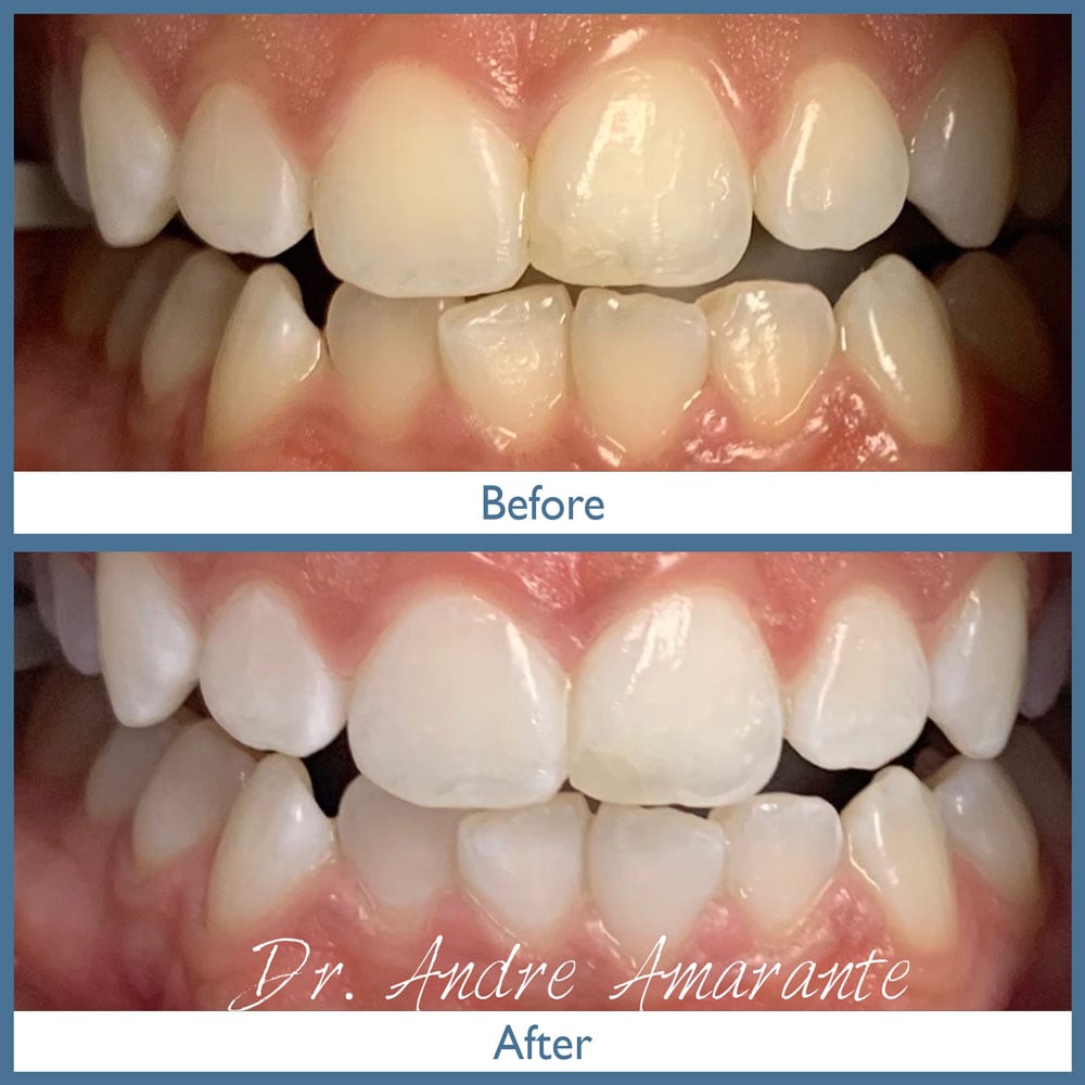 Way Dental Before and After in Evanston, IL