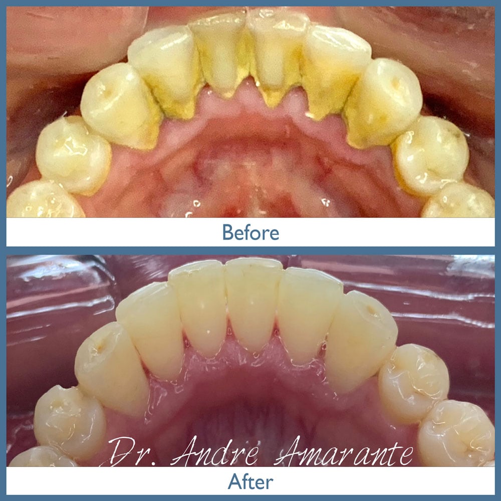 Way Dental Before and After in Evanston, IL