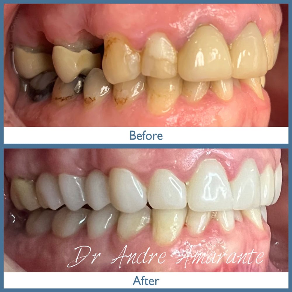 Way Dental Before and After in Evanston, IL