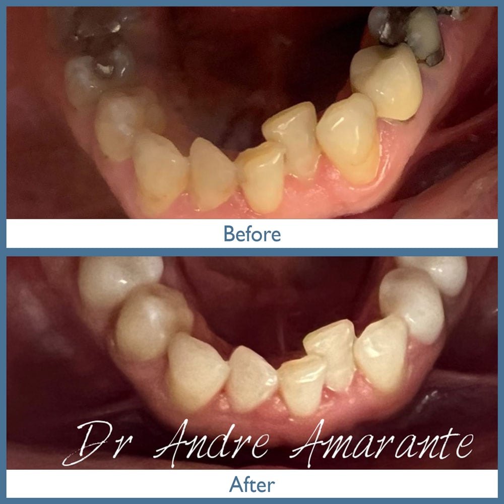 Way Dental Before and After in Evanston, IL