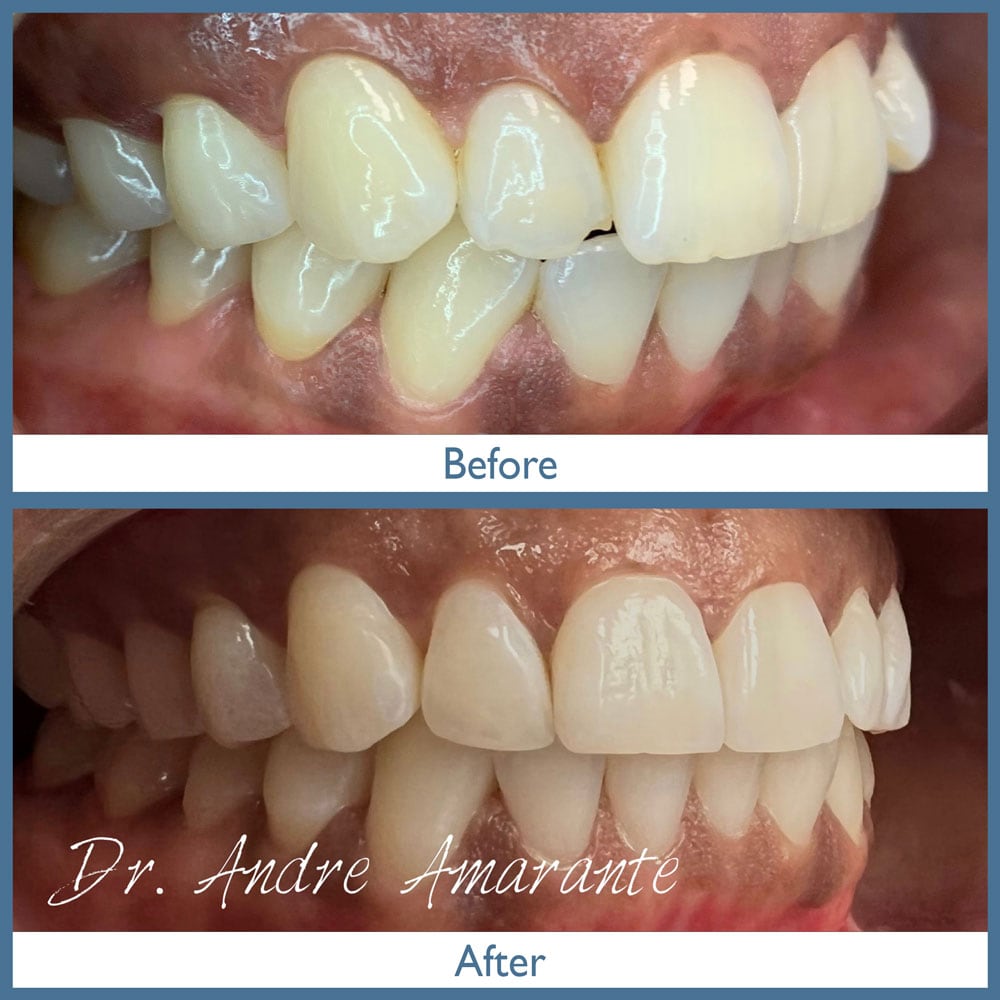 Way Dental Before and After in Evanston, IL