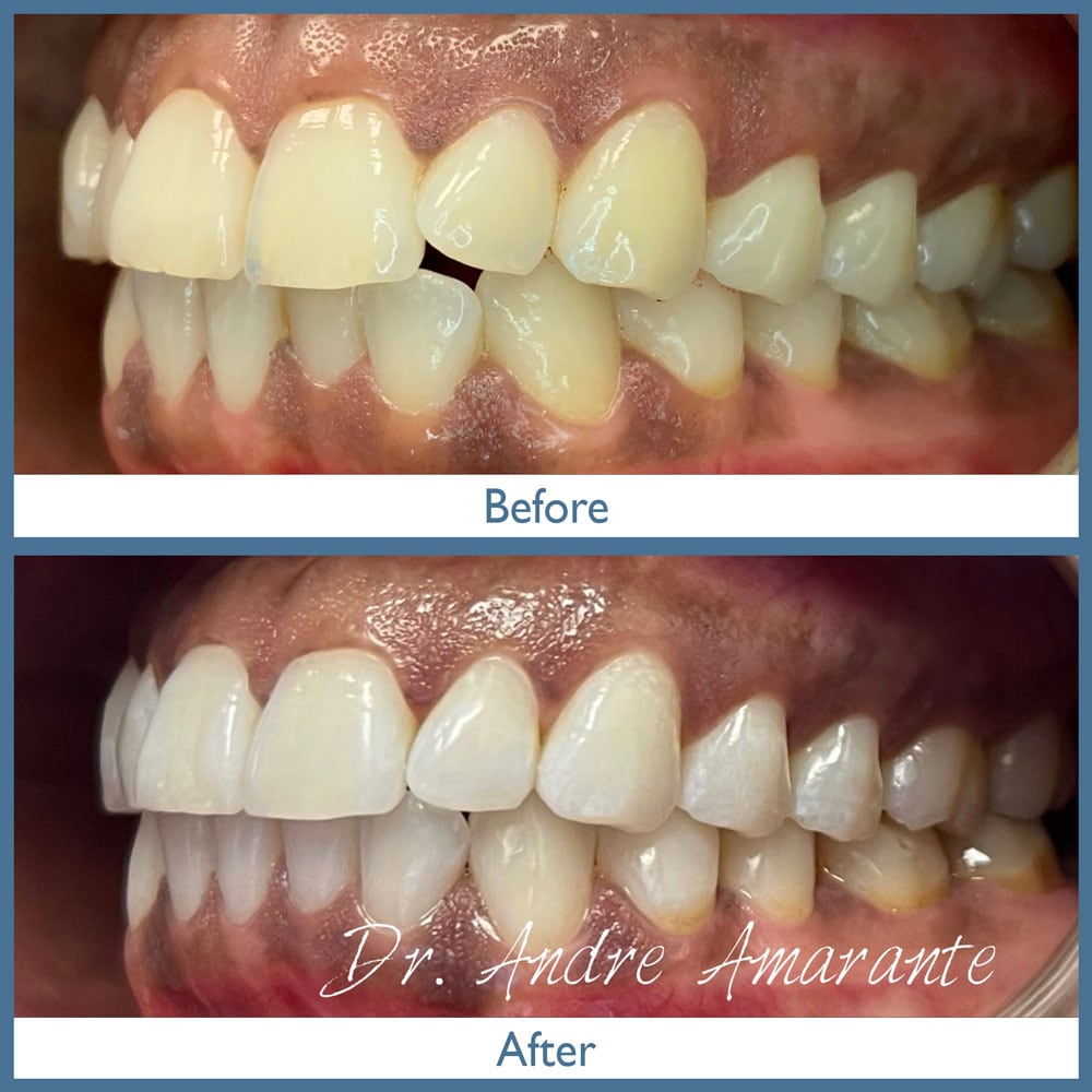 Way Dental Before and After in Evanston, IL