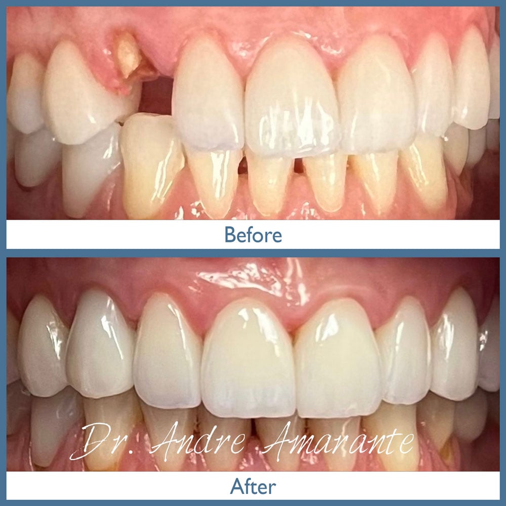 Way Dental Before and After in Evanston, IL