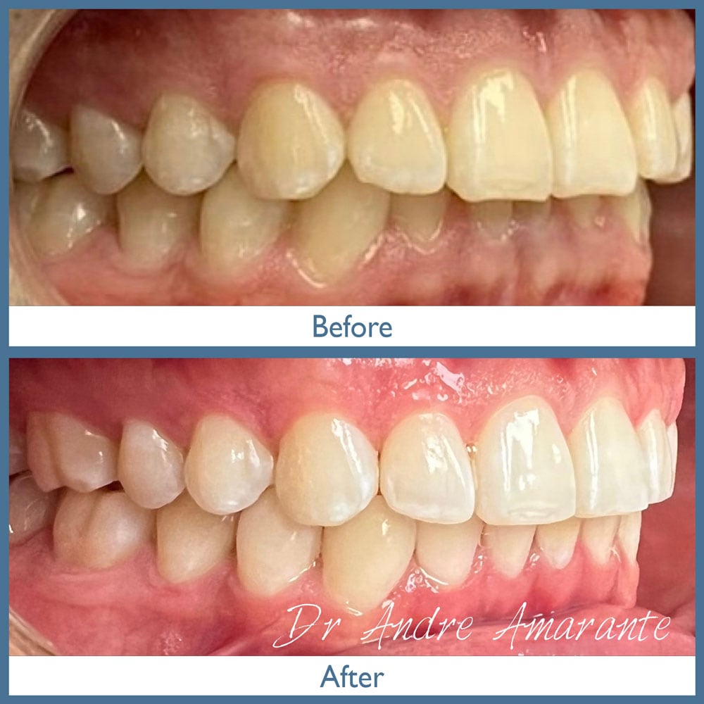 Way Dental Before and After in Evanston, IL